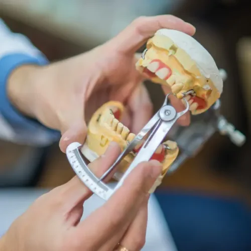 Prótesis híbridas DS DENTAL