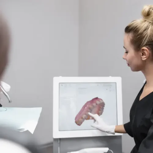 servicio exclusivo de férulas de descarga 3D DS DENTAL